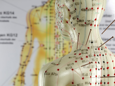 Chinese Dry Needling Gan Zhen methode