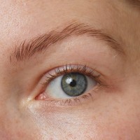 Focus-on Eye Behandeling