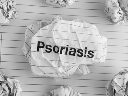 Huidprobleem #3 psoriasis